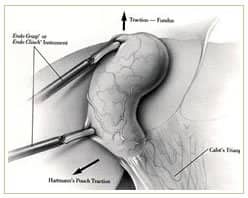 Slider image (5) Panama Gastric Surgery Center